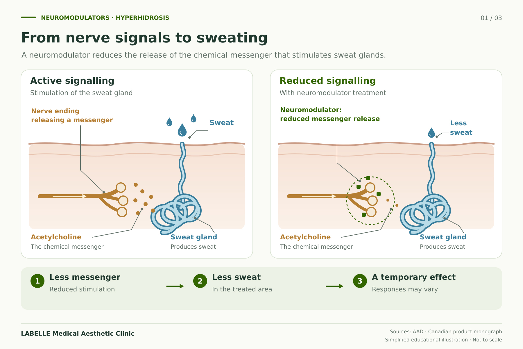 Hyperhidrosis or excessive sweating treatment in the aesthetic private clinic in Laval and Montreal